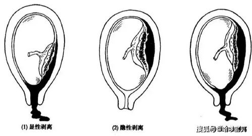 10女孩早发育打针对人体有影响吗?