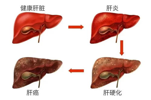 乙肝疫苗的注射