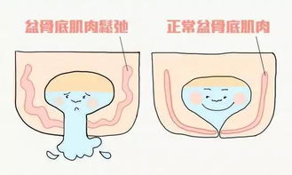 判断是否怀孕了的早期症状有哪些