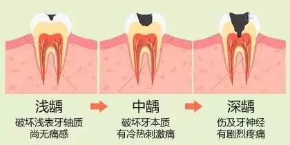 种植牙医保报销吗