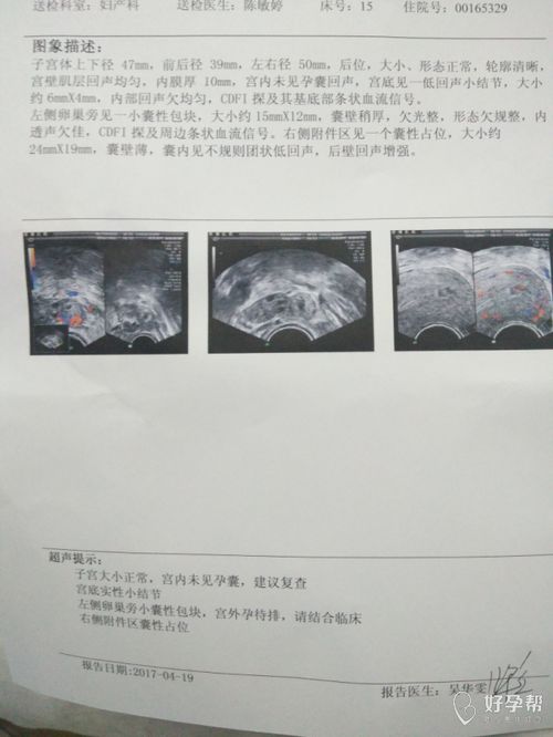 怀孕七周bc检查妊囊周边液性暗区是什么