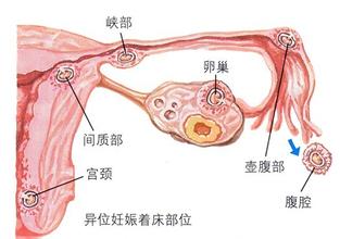 子宫输卵管切除容易衰老吗