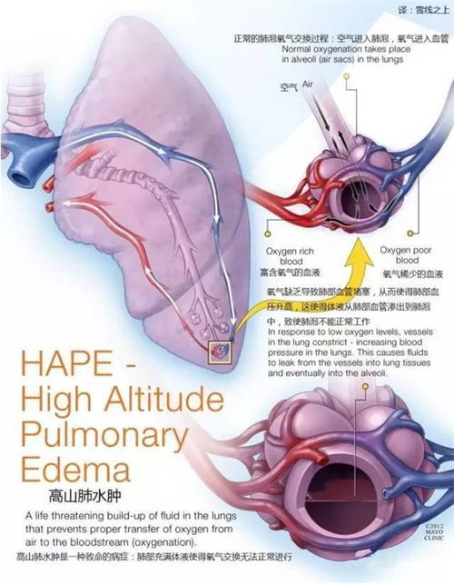 肺结核吃药期间可以过性生活吗