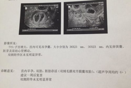 怀孕43天孕囊20.14是男孩女孩呀