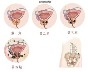 多吃什么对前列腺有好处