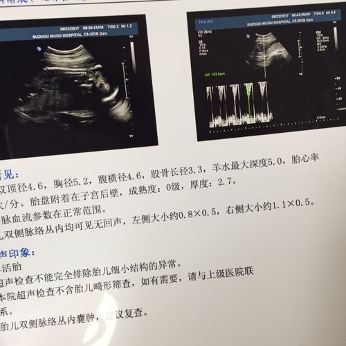 b超能检查到胎儿哪些情况呢