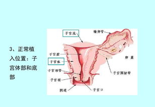 性疾病是什么症状