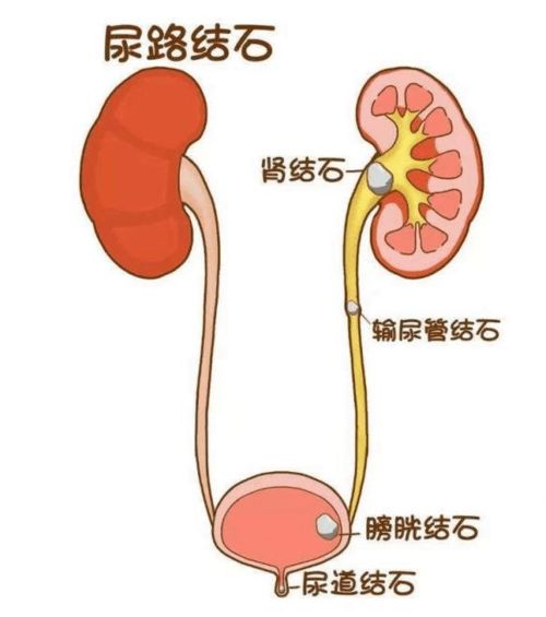 附睾炎的中药秘方