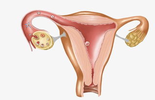 女性怎么保养卵巢不衰老