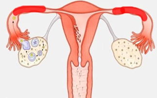 输卵管堵塞的症状?