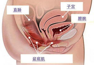 天津林医生产后修复机构,盆底肌修复有必要吗