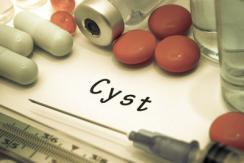 急性乳腺炎的防治方法有哪些