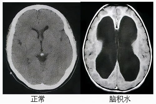 先天畸形是怎么造成的