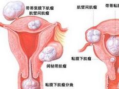 孕妇感染gbs的症状表现