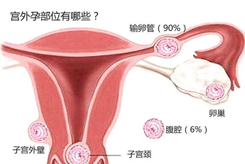 做了输卵管一侧结扎还能怀孕吗