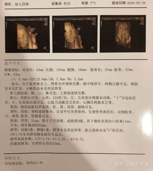 怀孕16周做唐筛需要空腹吗