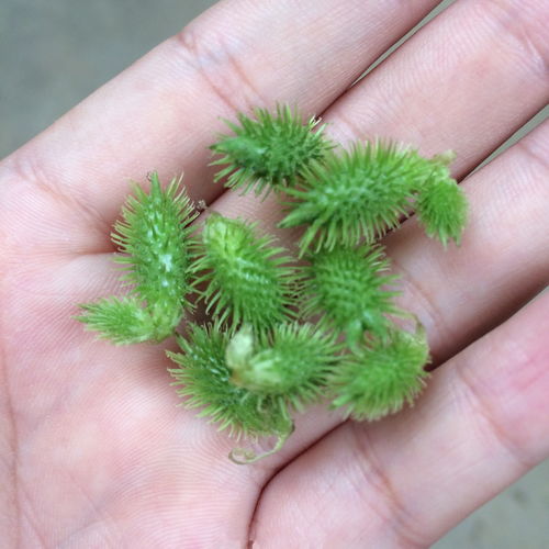 医治鼻炎的偏方？