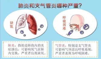 有治气管炎的偏方