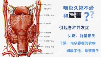 慢性咽炎不吃药能自愈吗