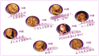 怀孕23周彩超数据