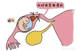 女性宫外孕增多的原因是什么呢