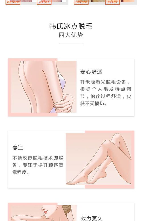 月经期间可以做冰点脱毛吗