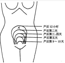 孕晚期喝什么茶去胎毒最好