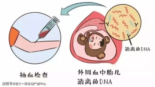 江西省儿童医院新生儿做染色体检查多久出结果