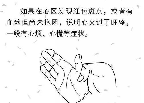 颈椎病有什么好办法