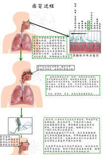 流鼻涕如何快速治疗