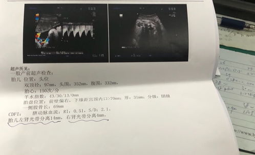 孕24周四维彩超上双肾未见分离是什么意思